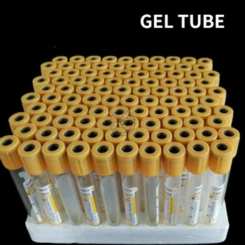 3ml 5ml 10 ml separacijskega Gela/Coagulant Cev Vakuumske Epruvete za odvzem Krvi za Laboratorijske Medicinske preiskave Krvi, PRP Cev