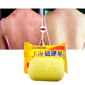 Shanghai Žvepla Milo Zdravljenje Aken Blackhead Odstranjevalec Milo Zob Čiščenje Olja-nadzor Tradicionalne Kitajščine za Nego Kože